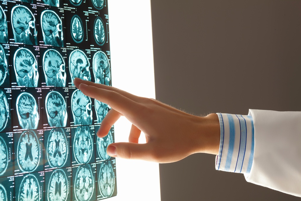 Mobile MRI Rentals - Review of Mobile MRI Scan Images